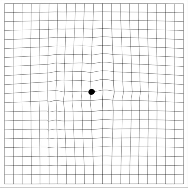 Amsler Grid