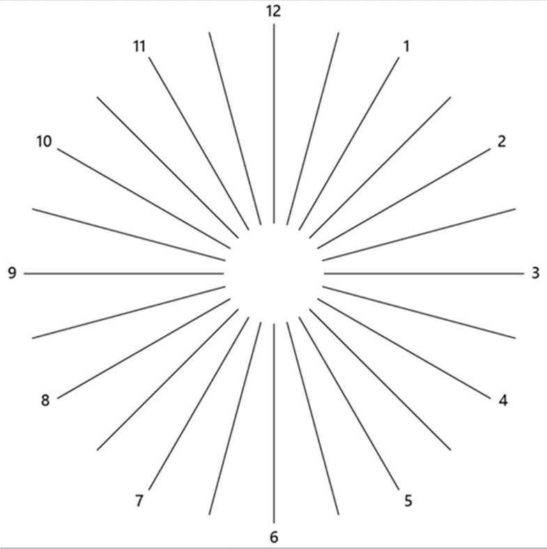 Astigmatism
