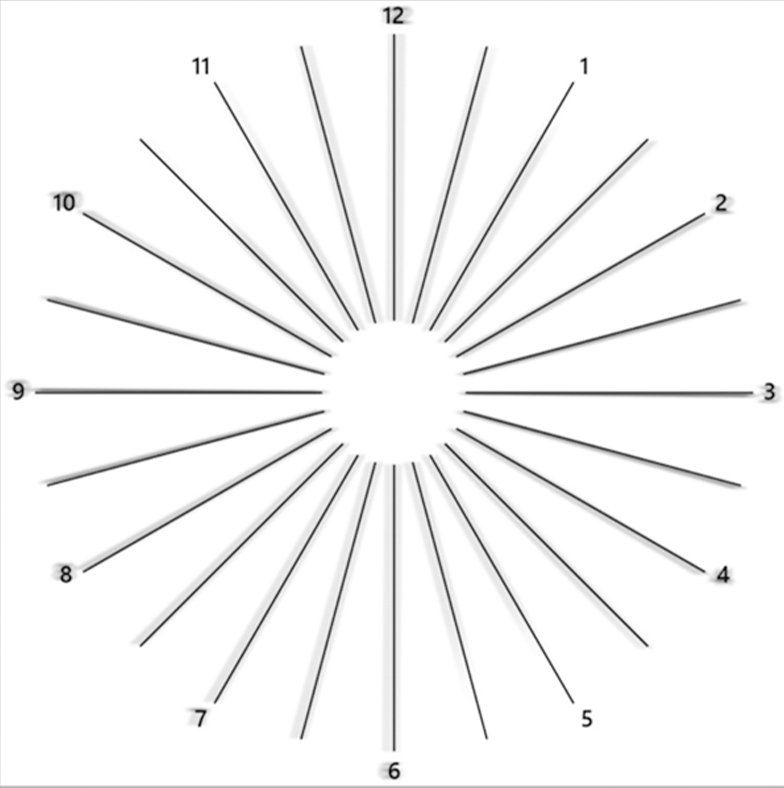 Astigmatism